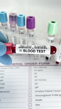 Lab technician holding Blood test tube for analysis of blood chemist study in the laboratory. doctor holding a blood testing over requisition report for analysis chemistry. portrait format