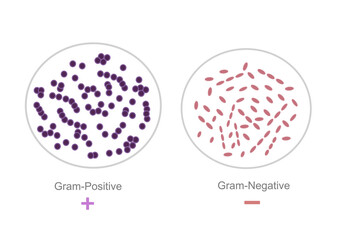 The interpretation result of gram-staining technique that showing Gram-Positive and Negative bacteria