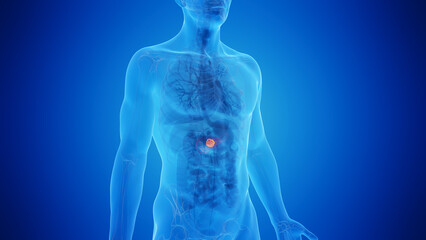 3D Rendered Medical Illustration of Male Anatomy - Pancreatic Cancer. Close up. Blue Background