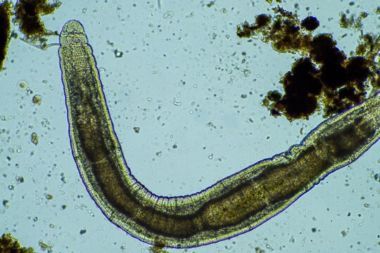 human parasites in the human gut