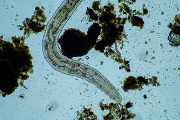 microorganisms and soil biology, with nematodes and fungi under the microscope. in a soil and...