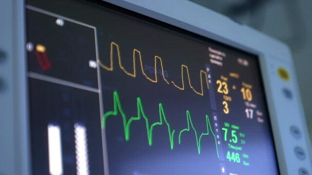 Green and orange curves running on the black screen of medical equipment. Close up. Life signs op the patient at surgery.