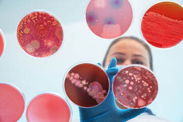Obraz na płótnie Canvas woman laboratory assistant analyze contents of petri dishes bottom view
