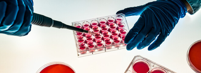 laboratory assistant in a microbiological laboratory doing PCR DNA analysis of biological samples on a 96 well plate