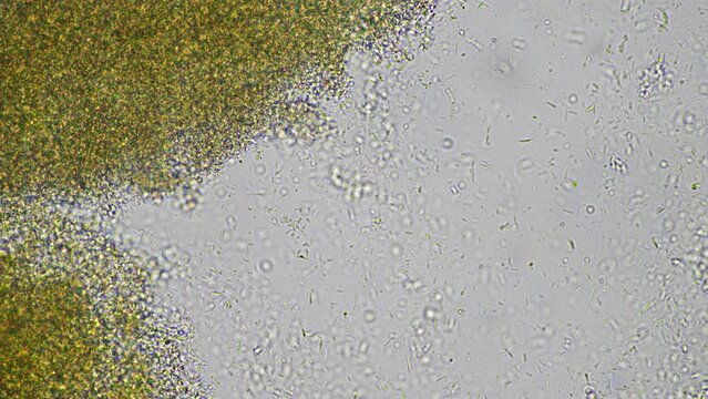baby feces under the microscope looking at poo with bacteria and bugs in a laboratory