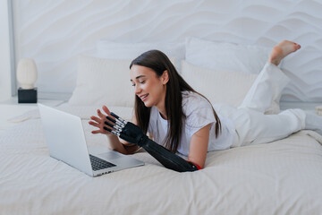 Cheerful young brunette girl with bionic artificial hand laying on bed with laptop makes video call...