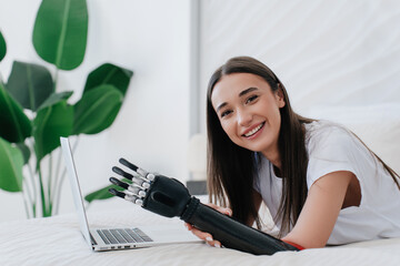 Brunette Italian girl with artificial carbon hand in white t-shirt connects artificial palm with artificial  hand, laying on bed home uses laptop to get instruction via video call. Human after trauma.