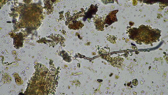 microorganisms and soil biology, with nematodes and fungi under the microscope. in a soil and compost sample