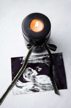Conceptual image of mourning, miscarriage, pregnancy loss or grief counseling. Ultrasound picture of baby next to black candle with black ribbon burning.