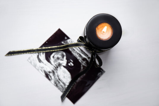 Conceptual image of mourning, miscarriage, pregnancy loss or grief counseling. Ultrasound picture of baby next to black candle with black ribbon burning.