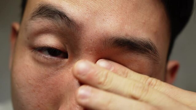 Asian man watching youtube content on mobile phone while rubbing his eyes