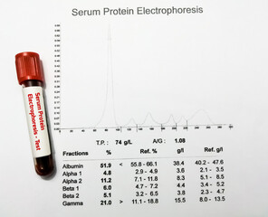 Blood sample and patient's report isolated for Protein Electrophoresis test. Close up.