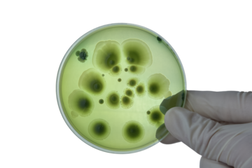 Hand with Petri dish or culture media with bacteria on white background with clipping, Test various germs, virus, Coronavirus, COVID-19, Microbial population count, Food science.