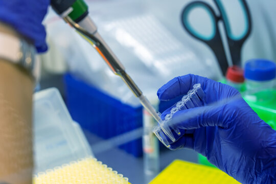 Scientist Pipettes Sample Into Vial For DNA Testing. Scientist Loads Sample DNA Monkeypox Amplification By PCR Into Plastic Strip Tubes. Hands In Blue Gloves Holds Pipette And Test Tube. Parental Test