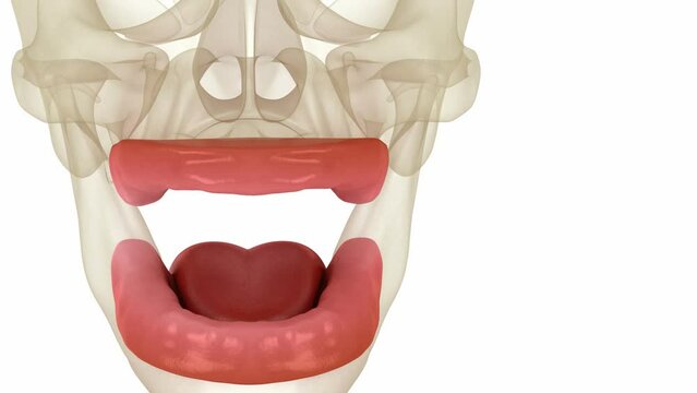 Removable prosthesis, artificial gum and teeth. Dental 3D animation