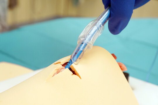 Insertion of the ventilation tube into the air tube of an air tube training model based on a pig larynx