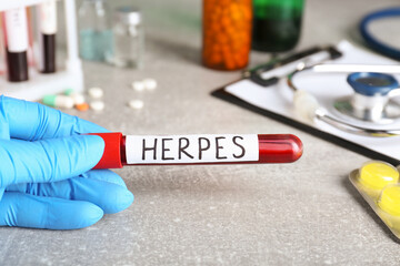 Doctor in glove holding test tube with word Herpes at light grey table, closeup