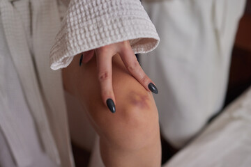 Bruise on the leg of a woman. A bruised leg. Close-up.