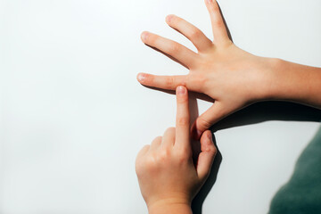 Children's hand with a wart on a white background. Papilomavirus. View from above - obrazy, fototapety, plakaty