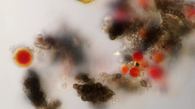 Haematococcus pluvialis under a microscope. This species is well known for its high content of the strong antioxidant astaxanthin, which is important in aquaculture, healthcare and cosmetics.