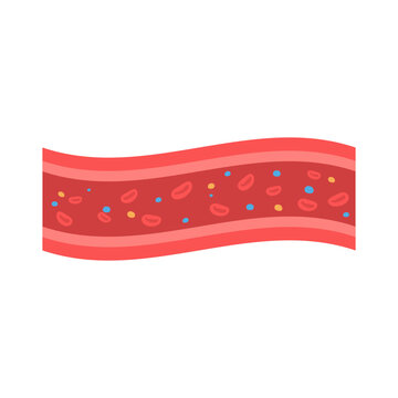 Coronary Arteries With Accumulated Fat In The Body