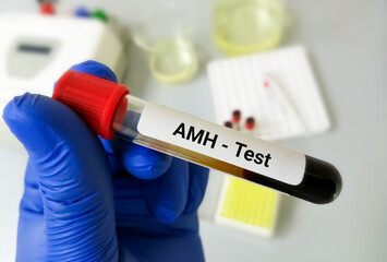 Blood sample tube for AMH  (anti-mullerian hormone) test, evaluate of ovarian function and fertility in woman