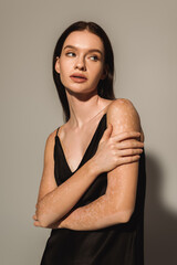 Obraz premium Pretty woman with vitiligo posing in satin dress and looking away on grey background.