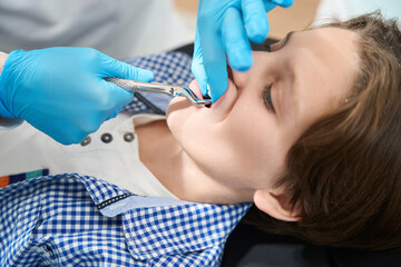 Boy is having a tooth removed in a dental clinic