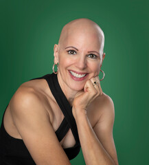 Pretty middle age over 50 woman with hair loss isolated on green background - 549123489