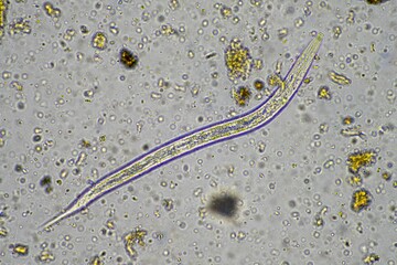 microorganisms and soil biology, with nematodes and fungi under the microscope. in a soil and compost sample