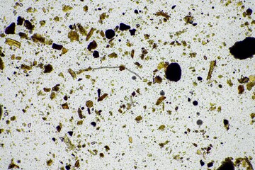 soil fungi and microorganisms in a soil and compost sample