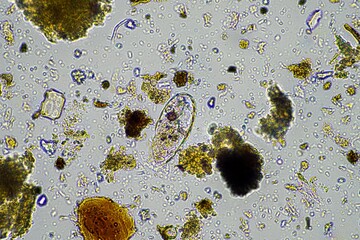 soil fungi and microorganisms in a soil and compost sample