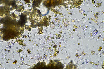 soil fungi and microorganisms in a soil and compost sample