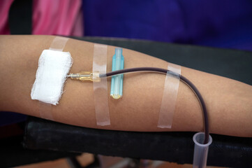 Close up arm of female donor giving blood at donation center, Blood supply and Blood...