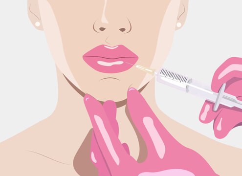 Cosmetologist does lip augmentation procedure of a beautiful woman. Cosmetology concept. vector image