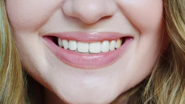 close-up. a woman's smile in the process of whitening teath