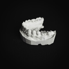 Impresi&oacute;n bucal