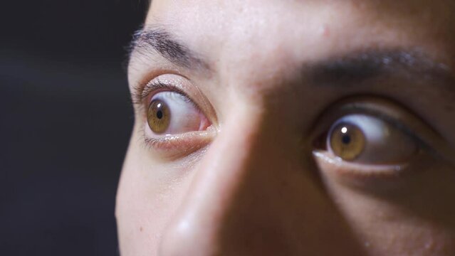 Close-up of depressed eyes.
Close-up eyes of schizophrenic man.
