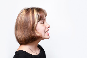A cute young girl in profile, but she has crooked teeth on her upper jaw, the problem of crooked...