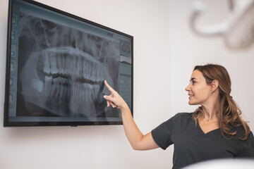 medicine, dentistry and health care concept - female dentist pointing to tooth showing x-ray of...