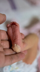 Newborn heel prick test and lood puncture, Taking a Heel Blood Sample From Newborn Baby