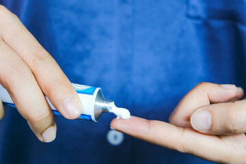 The woman's hand, she uses steroids Apply External type