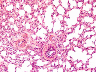 guinea pig lung transverse section under the microscope - optical microscope x200 magnification