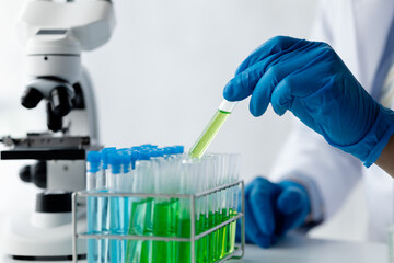 Lab assistant, a medical scientist, a chemistry researcher holds a glass tube through the blood sample, does a chemical experiment and examines a patient's blood sample. Medicine and research concept.