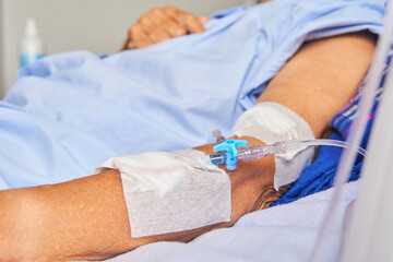 detail of arm of senior lady with intravenous line lying on stretcher in hospital room