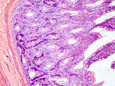 small intestine cross section under the microscope - optical microscope x200 magnification
