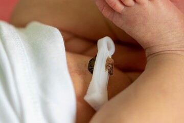 Close up of a foot and a clamped umbilical cord of a newborn baby - the concept of childbirth