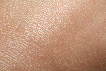 Closeup view of dry human skin as background