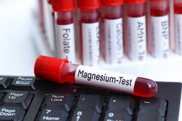 Magnesium test to look for abnormalities from blood