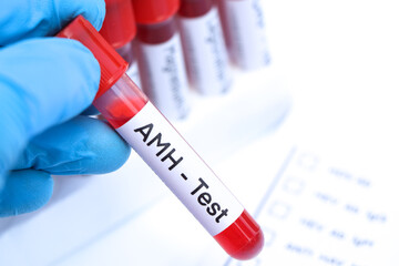 AMH test to look for abnormalities from blood